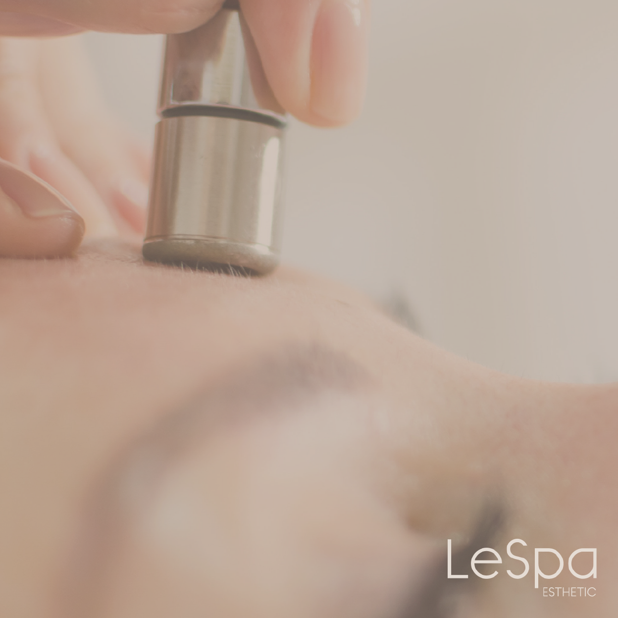 Microdermabrasión con punta de diamante