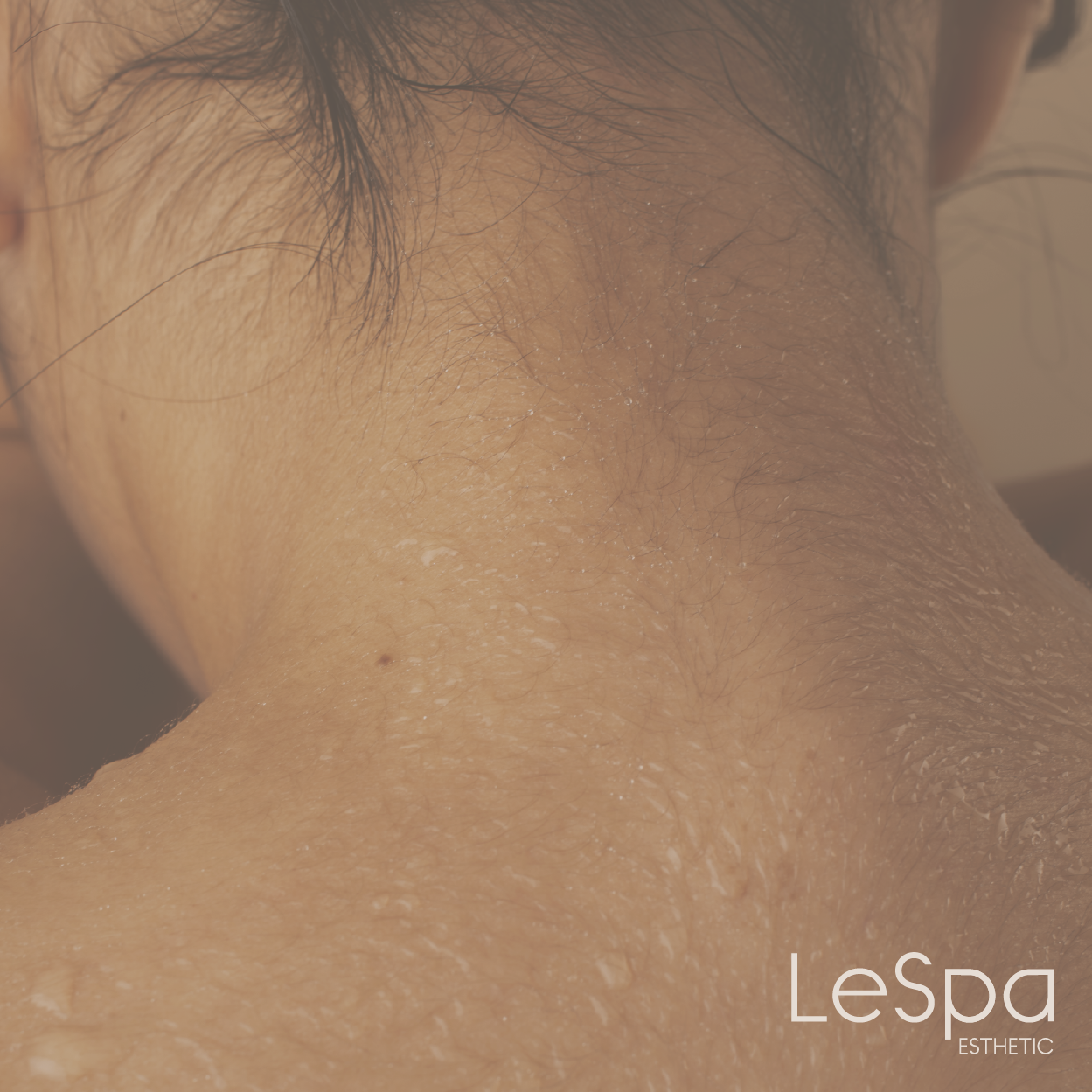 Detox Corporal (Manta Térmica + Drenaje Linfático)