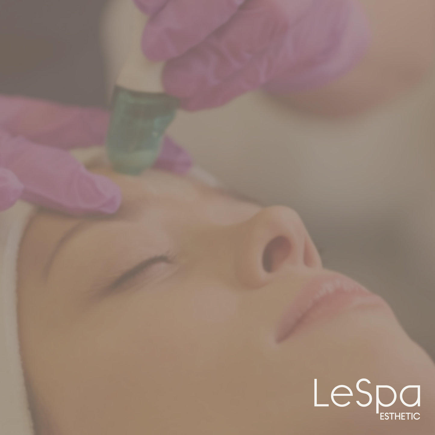 Microdermabrasión con cristales de corundum